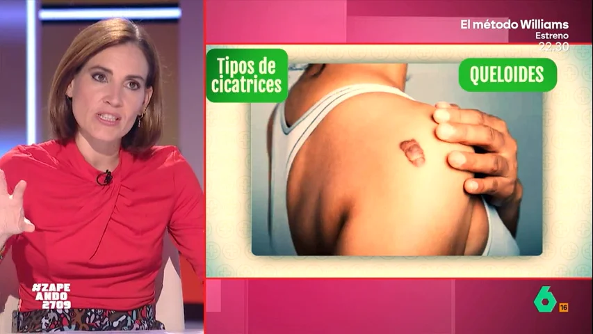 ¿Cuántos tipos de cicatrices existen? Boticaria García te lo explica