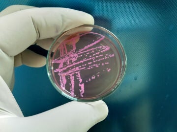 Bacteria Shigella