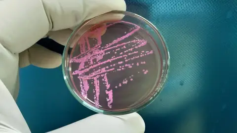 Bacteria Shigella Bacteria Shigella