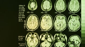 Imagen de resonancia magnética de un cerebro humano