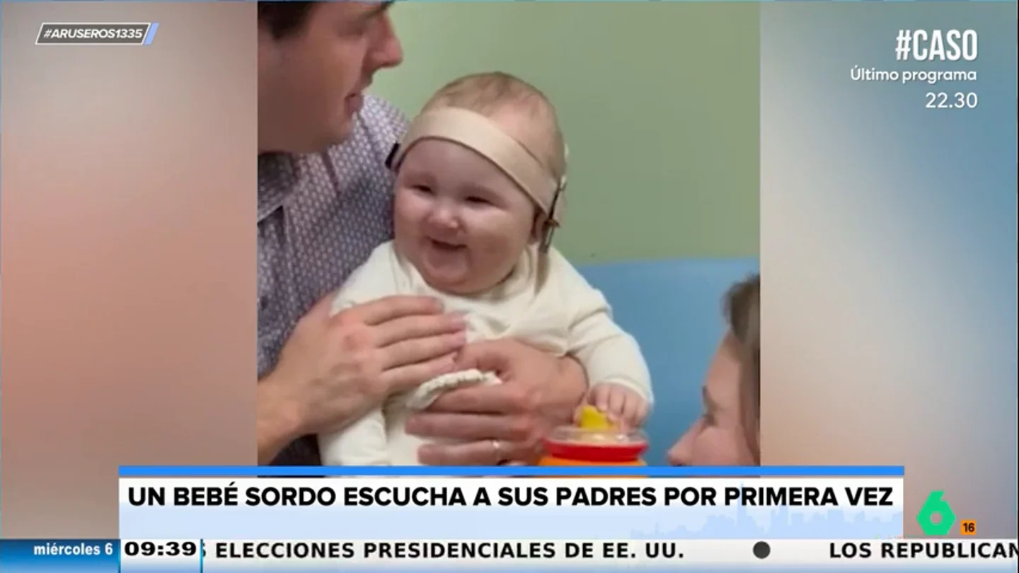 Un bebé sordo escucha a sus padres por primera vez Un bebé sordo escucha a sus padres por primera vez