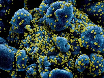 Un test genómico detecta casi cualquier patógeno Un test genómico detecta casi cualquier patógeno