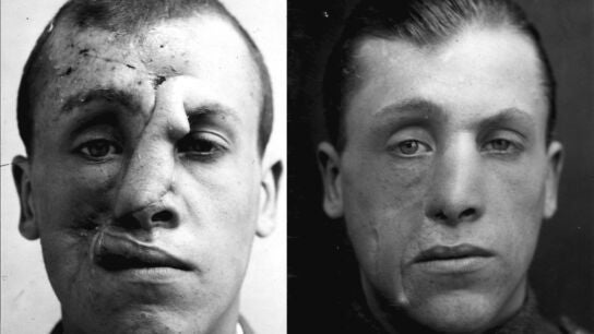 El sargento Sidney Beldman result&oacute; herido en la batalla de Passchendaele