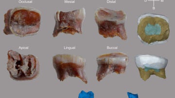 dientes de neandertal