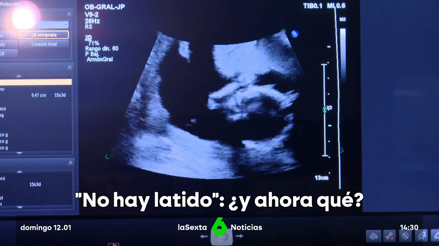 MUERTE PERINATAL MUERTE PERINATAL