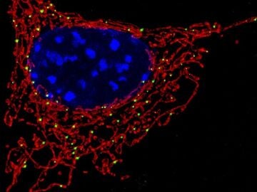 Imagen de una mitocondria, donde se encuentra la prote&iacute;na MCJ