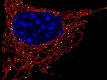 Imagen de una mitocondria, donde se encuentra la proteína MCJ Imagen de una mitocondria, donde se encuentra la proteína MCJ