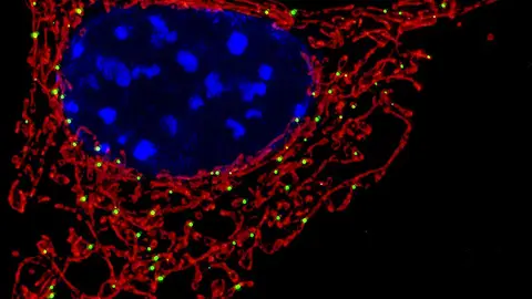 Imagen de una mitocondria, donde se encuentra la proteína MCJ Imagen de una mitocondria, donde se encuentra la proteína MCJ