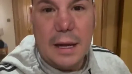 La petición de Lucas, de 'Andy y Lucas', tras las críticas por su operación de nariz: "No puede ser que uno tenga miedo de salir a la calle" La petición de Lucas, de 'Andy y Lucas', tras las críticas por su operación de nariz: "No puede ser que uno tenga miedo de salir a la calle"