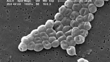 bacteria Acinetobacter_baumannii