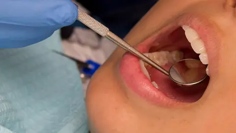 Revisión dental Revisión dental