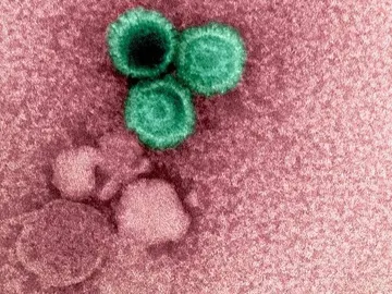 Virus de Epstein-Barr Virus de Epstein-Barr