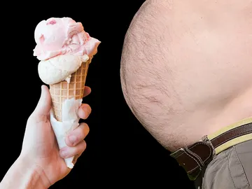 Obesidad Obesidad