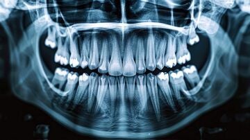 implantes de titanio biocomplatibles