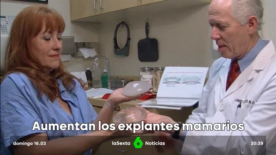 Aumentan los explantes mamarios Aumentan los explantes mamarios