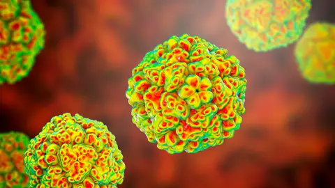 Enterovirus Enterovirus