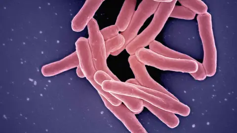 Los casos de tuberculosis infantil aumentan un 26 en la Union Europea Los casos de tuberculosis infantil aumentan un 26 en la Union Europea