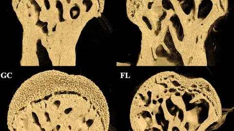 Cuello femoral de ratones de control terrestre (GC y VIV) y ratones astronautas (FL y BL) Cuello femoral de ratones de control terrestre (GC y VIV) y ratones astronautas (FL y BL)