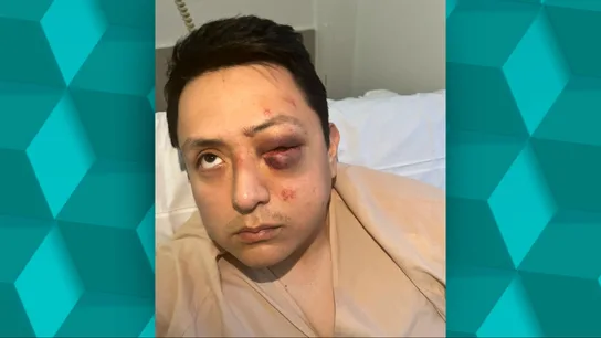 Casi pierde un ojo tras una brutal agresión racista en el Metro de Madrid: "Vinieron a pegarme llamándome 'panchito'" Casi pierde un ojo tras una brutal agresión racista en el Metro de Madrid: "Vinieron a pegarme llamándome 'panchito'"