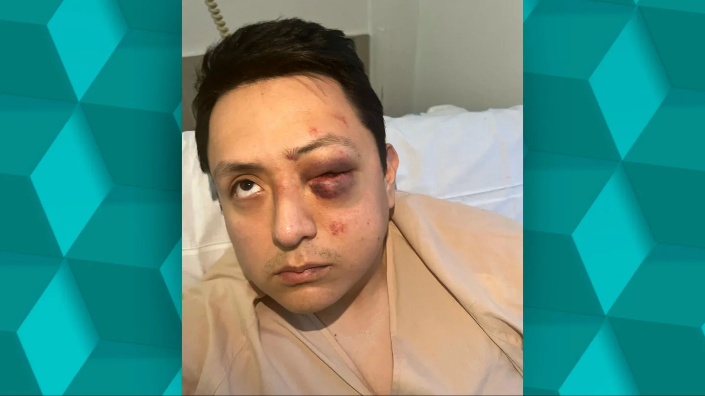 Casi pierde un ojo tras una brutal agresión racista en el Metro de Madrid: "Vinieron a pegarme llamándome 'panchito'" Casi pierde un ojo tras una brutal agresión racista en el Metro de Madrid: "Vinieron a pegarme llamándome 'panchito'"