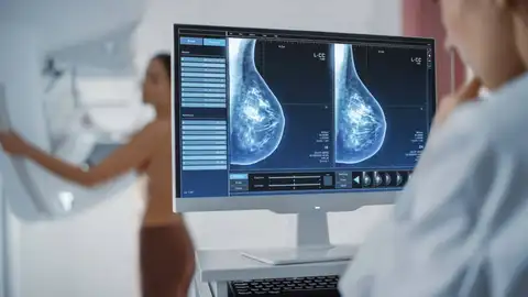 Las dietas grasientas favorecen la metastasis del cancer de mama en ratonas Las dietas grasientas favorecen la metastasis del cancer de mama en ratonas