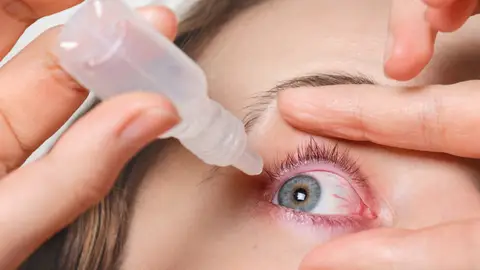 Desarrollan unas gotas oculares como posible terapia para la retinosis pigmentaria Desarrollan unas gotas oculares como posible terapia para la retinosis pigmentaria