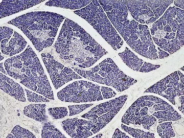 Mas cerca del objetivo de tratar la diabetes tipo 1 con trasplantes de islotes pancreaticos Mas cerca del objetivo de tratar la diabetes tipo 1 con trasplantes de islotes pancreaticos