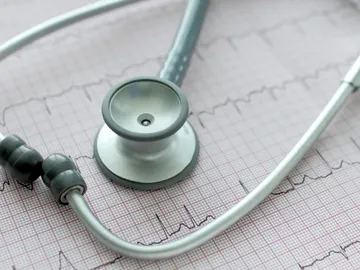Estetoscopio sobre el ECG Estetoscopio sobre el ECG
