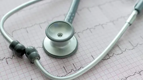 Estetoscopio sobre el ECG Estetoscopio sobre el ECG