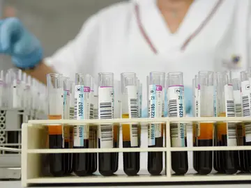 Muestras de sangre Muestras de sangre