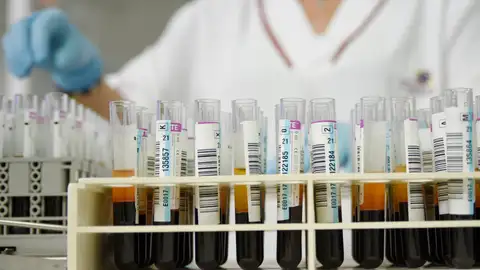 Muestras de sangre Muestras de sangre