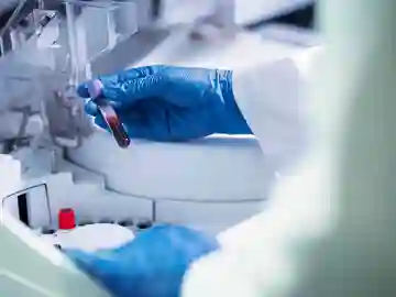 La gepotidacina nuevo farmaco seguro y eficaz para la gonorrea La gepotidacina nuevo farmaco seguro y eficaz para la gonorrea