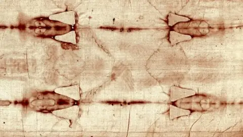 Fragmento de la fotografía de la Sábana Santa de Turín Fragmento de la fotografía de la Sábana Santa de Turín