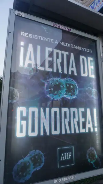 Gonorrea Gonorrea
