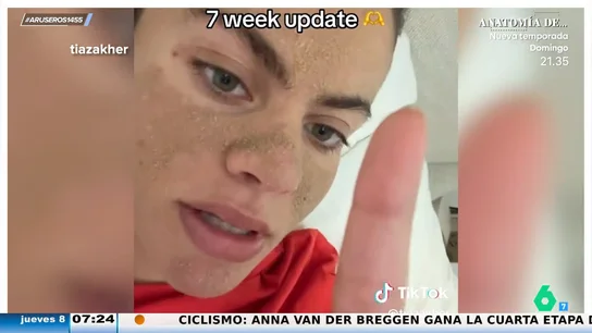 Una influencer lleva siete semanas sin lavarse la cara: así es la nueva moda del 'anti skincare' Una influencer lleva siete semanas sin lavarse la cara: así es la nueva moda del 'anti skincare'