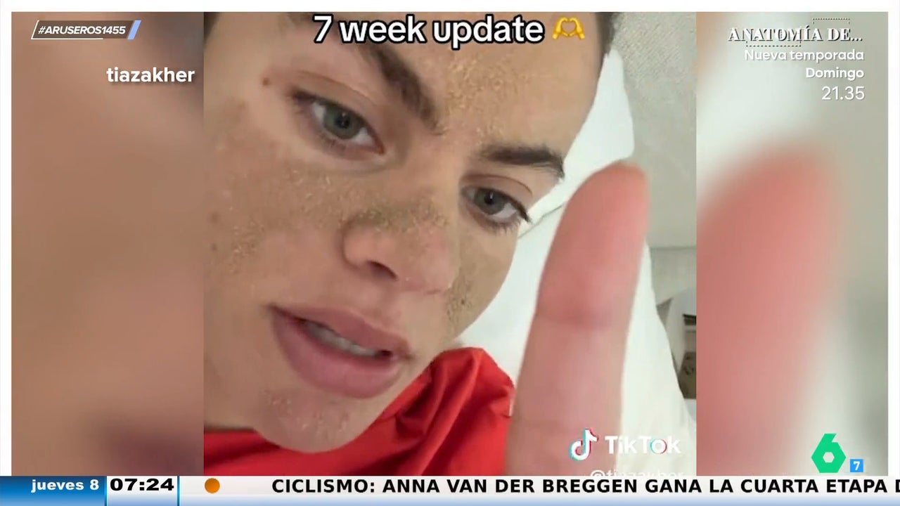 Influencer sin lavarse la cara