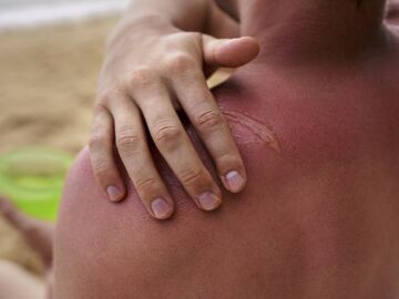 Una pastilla de una planta prehist&oacute;rica para protegernos del sol