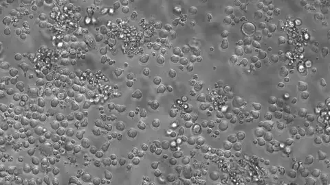 Cultivo de células madre hematopoyéticas de ratón Cultivo de células madre hematopoyéticas de ratón