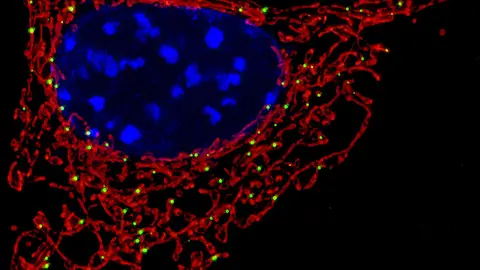Mitocondria Mitocondria