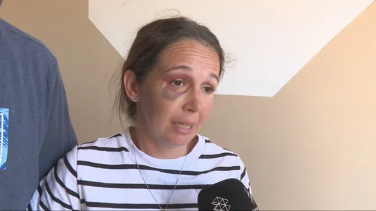 Eloísa Muñoz, agredida junto a su pareja por un grupo de okupas Eloísa Muñoz, agredida junto a su pareja por un grupo de okupas