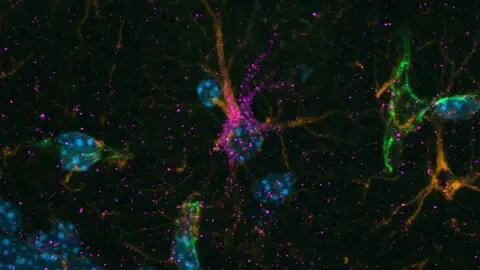 Astrocitos (naranja), vasos sanguíneos (verde) y núcleos celulares (azul) Astrocitos (naranja), vasos sanguíneos (verde) y núcleos celulares (azul)