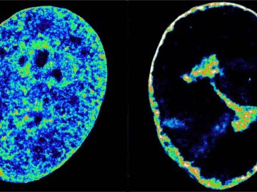 C&eacute;lulas humanas antes y despu&eacute;s de la infecci&oacute;n por el herpes labial