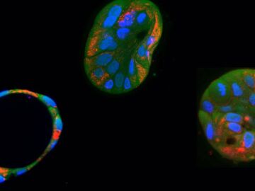 La edici&oacute;n gen&eacute;tica logra corregir mutaciones mitocondriales da&ntilde;inas en c&eacute;lulas humanas