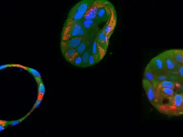 La edición genética logra corregir mutaciones mitocondriales dañinas en células humanas La edición genética logra corregir mutaciones mitocondriales dañinas en células humanas