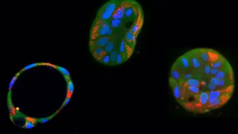 La edición genética logra corregir mutaciones mitocondriales dañinas en células humanas La edición genética logra corregir mutaciones mitocondriales dañinas en células humanas