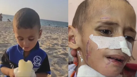 El antes y después de Amr, el niño gazatí con secuelas tras un ataque israelí El antes y después de Amr, el niño gazatí con secuelas tras un ataque israelí