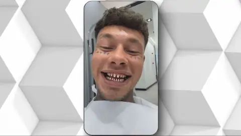 Una sonrisa barata puede salir muy cara Una sonrisa barata puede salir muy cara