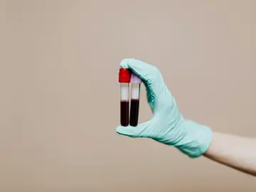 Una mano sosteniendo dos tubos de sangre para ser analizados Una mano sosteniendo dos tubos de sangre para ser analizados