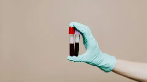 Un test permite detectar el cáncer en fases iniciales con una muestra de sangre Botes de sangre para análisis
