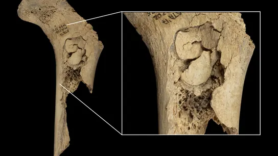 Nuevo episodio de canibalismo en el Yacimiento de Atapuerca (Burgos). Nuevo episodio de canibalismo en el Yacimiento de Atapuerca (Burgos).